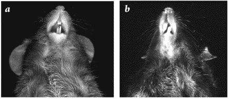 malocclusion vs normal incisors