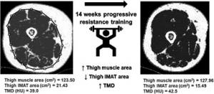 Associations of muscle lipid content with physical function and resistance training outcomes in older adults: altered responses with metformin