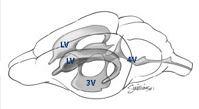 schematic of cerebral ventricles of normal mouse