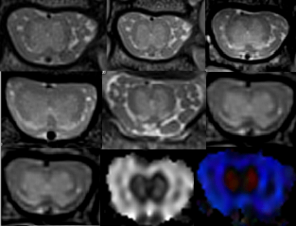 spine rat mri