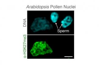 A microscopic image of Arabidopsis pollen nuclei showing the removal of epigenetic memories specifically in sperm genomes. Photo by Michael Borg, Gregor Mendel Institute, Austria.