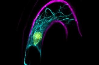 An image of a confocal microscope image of the Arabidopsis female cell including the nucleus in yellow and intracellular cables which help with sperm nucleus migration upon fertilization.