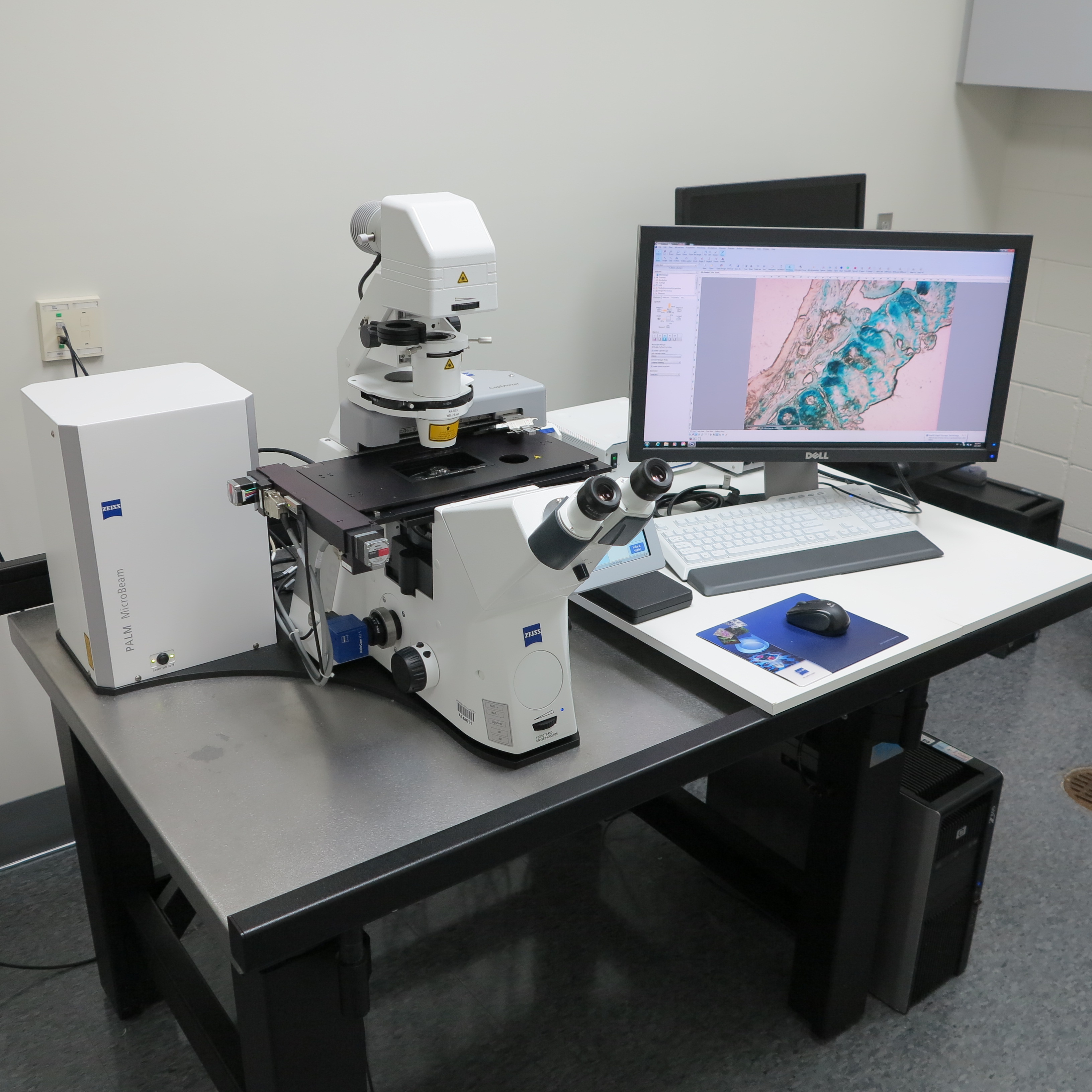 Zeiss Microcapture